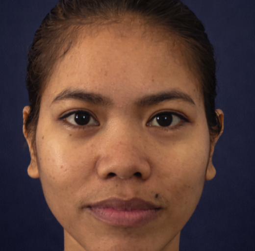 Before/After Image
